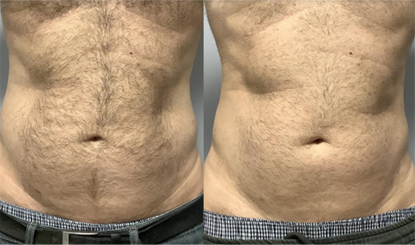 Rogue Mens Wellness Lounge - Before After 2
